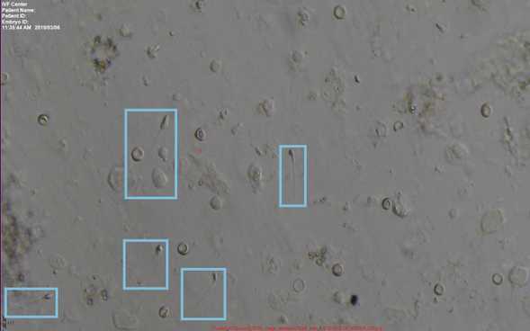 Labelled Sperm Data